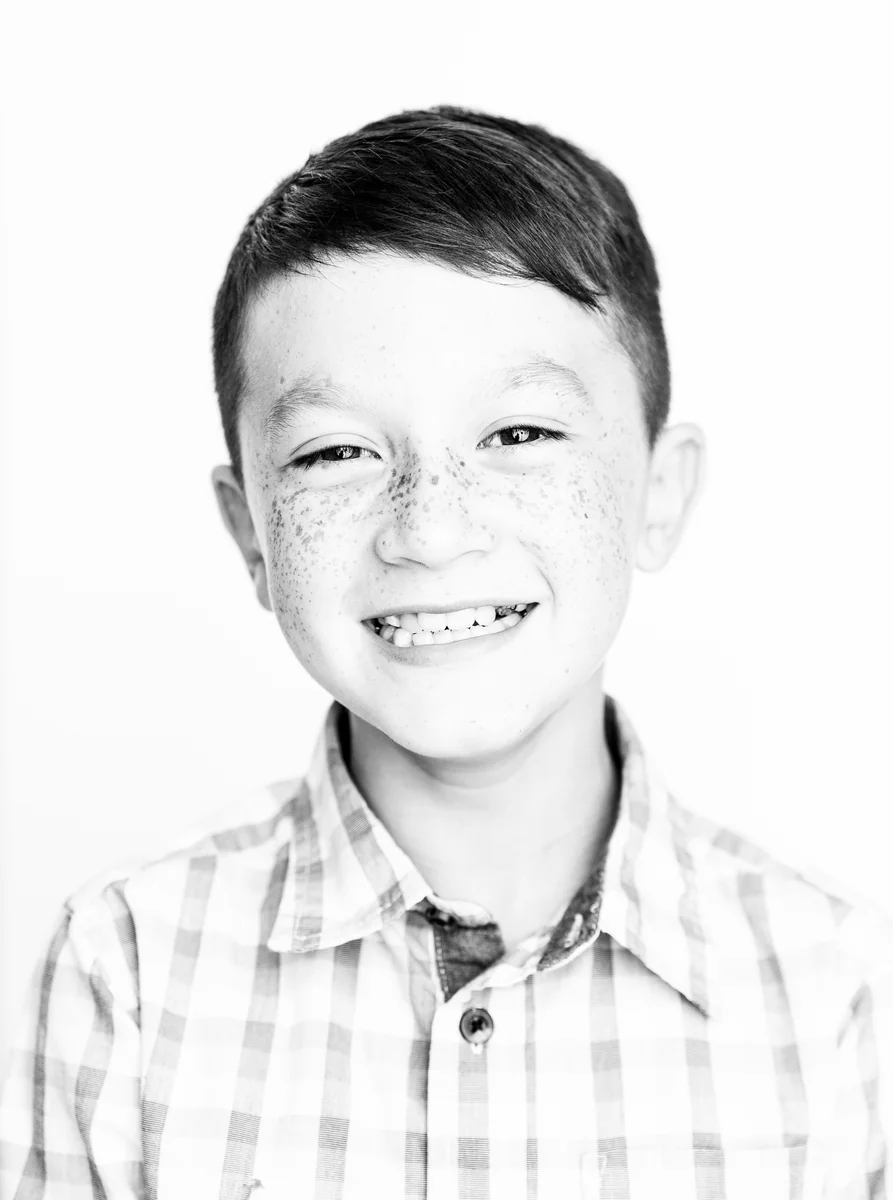 Oasis Orthodontics patient, Case 07